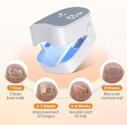 Fungal Nail Laser Device Repair Fast Toenail Nail Fungus Feet