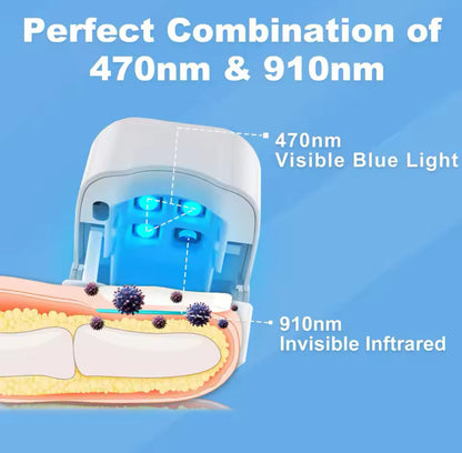 Fungal Nail Laser Device Repair Fast Toenail Nail Fungus Feet