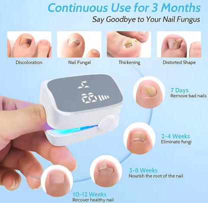 Fungal Nail Laser Device Repair Fast Toenail Nail Fungus Feet