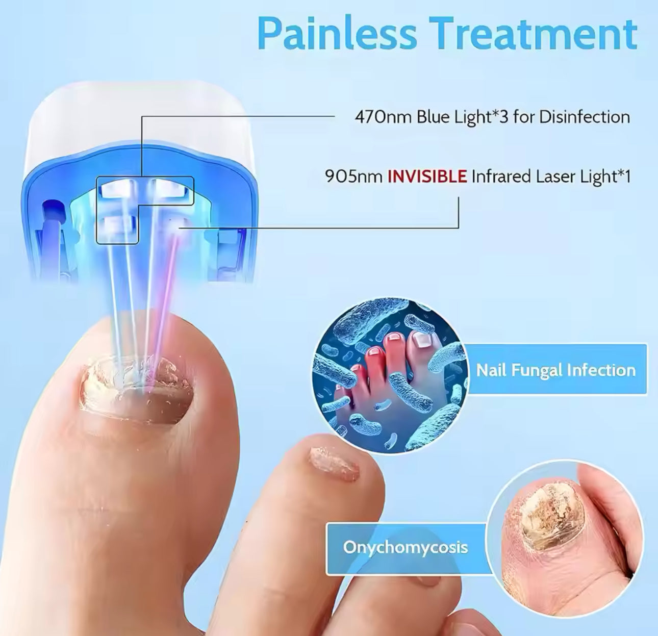 Fungal Nail Laser Device Repair Fast Toenail Nail Fungus Feet