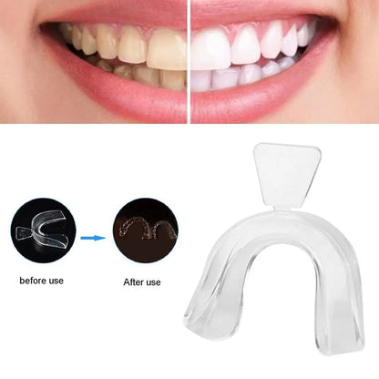 2pcs Silicone Night Mouth Guard For Teeth Clenching Grinding Dental Bite Sleep Aid Whitening Teeth Mouth Tray