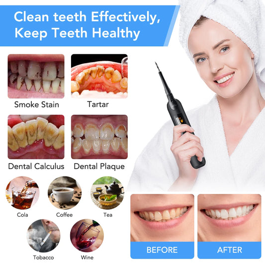 Electric Teeth Whitening Cleaning Kit LED Light Dental Sonic Scaler Cleaner Tartar Calculus Stains Remover Tool with Oral Mirror